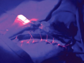 Riverpoint VisiPro™ Fluorescent Sutures 2