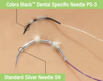 Riverpoint Cobra Black™ Dental Specific Needles 1